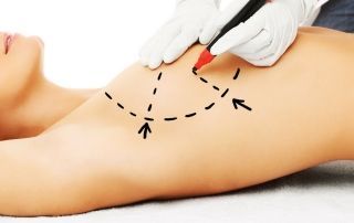 Mamoplastia y Buceo